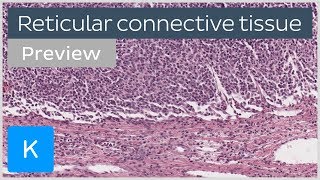 Reticular connective tissue: cells and structure (preview) - Human Histology | Kenhub