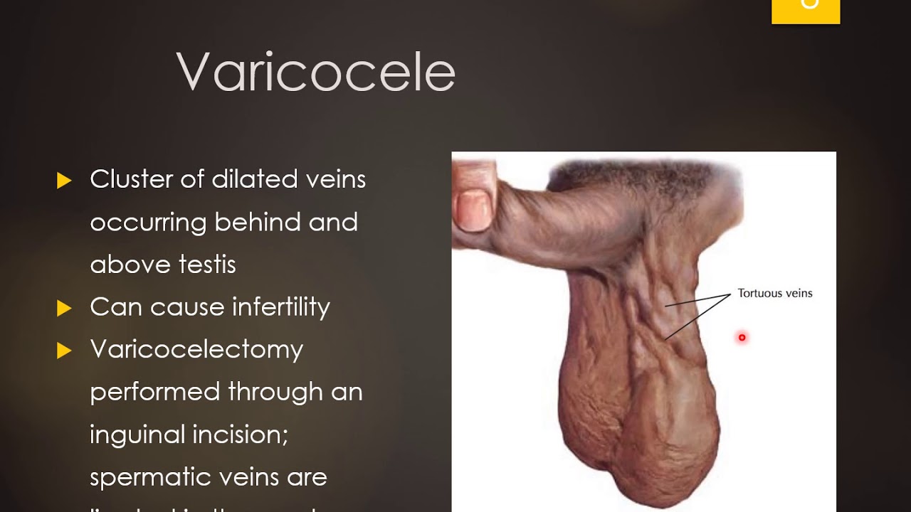 Erectile Dysfunction and Androgens YouTube