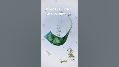 #Microbial #Diversity #Invisible world of microbes.. 🔬