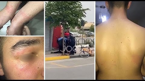 Ora News - Pezullohet polici që dhunoi të miturin te zona e Liqenit Artificial