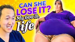Plastic Surgeon Reacts to MY 600 Lb LIFE: INCREDIBLE Transformation!