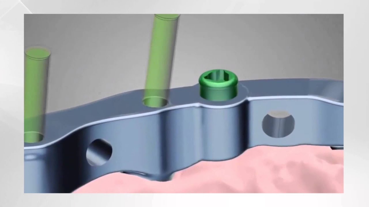 Dental Wings Overview