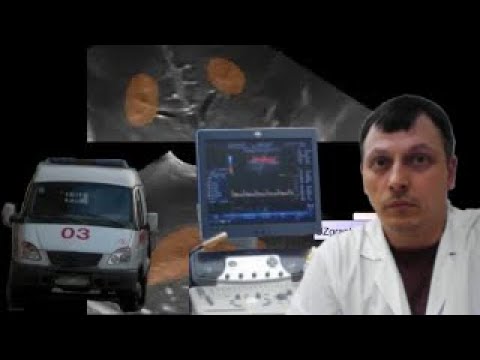 Детская Нейросонография (УЗИ головного мозга) - Перивентрикулярная лейкомаляция у ребенка