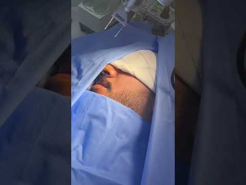 علاج الندبات بالليزر علاج بالليزر الليزر تجميل