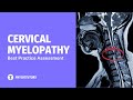 Cervical myelopathy assessment  best practice metaanalysis