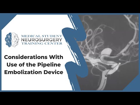 Considerations With Use of the Pipeline Embolization Device