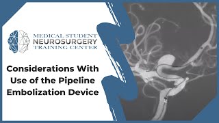 Considerations With Use of the Pipeline Embolization Device