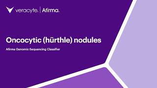 Afirma GSC | Oncocytic (Hürthle) Nodules