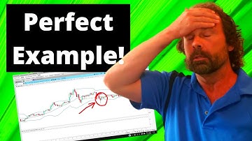 Why I Hate Nadex Daily Strikes! Nadex Binary Options Trading Strategies