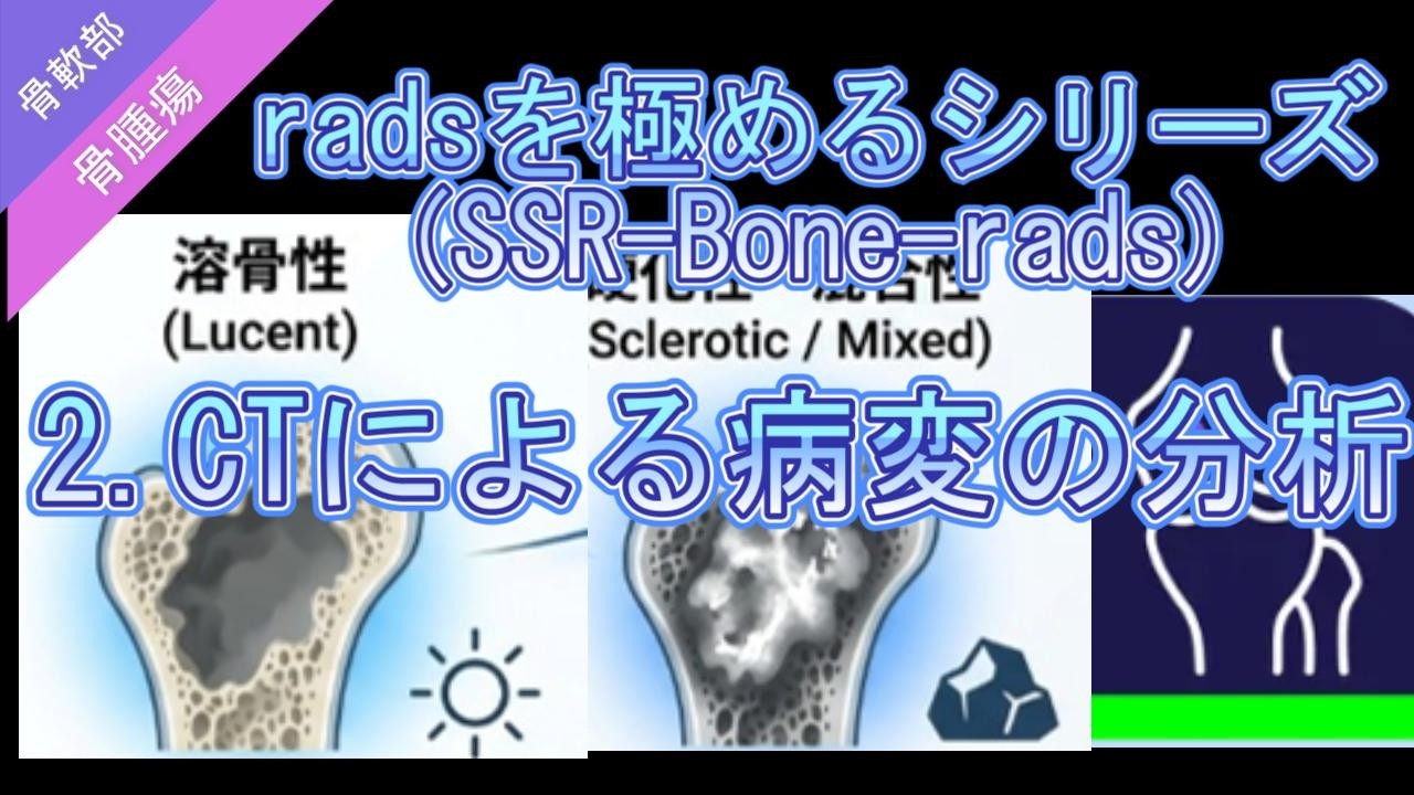 SSR Bone-rads を極めるシリーズ2 CTによる病変の分析 - YouTube
