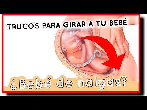 Vídeo: Bebé Calmante: Técnicas Para Ayudar A Que El Bebé Se Acomode