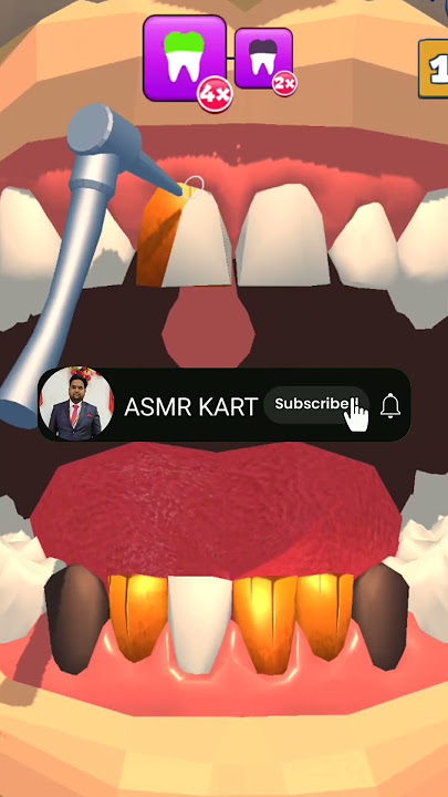 Best asmr video of tooth cleaning asmr animation