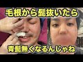 【閲覧注意】髭Wax脱毛で青髭無くせるんじゃない？