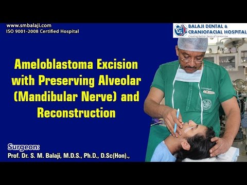 Excize ameloblastomu se zachováním alveolárního mandibulárního nervu a rekonstrukcí