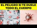 ALERTA! Por Esta Peligrosa Razón TE DUELE el CUERPO, Y Nadie Te Lo Dice