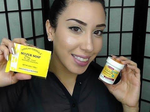 Clear Acne FAST Using Sulfur !!! ♥