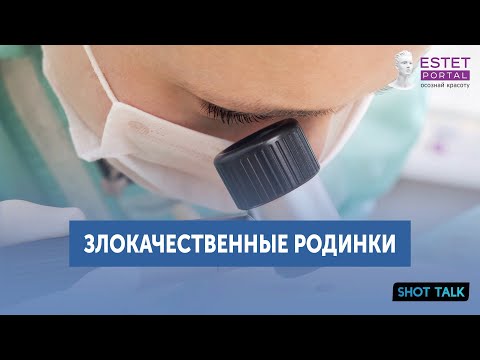 ЗЛОКАЧЕСТВЕННЫЕ РОДИНКИ / КАК ОПРЕДЕЛИТЬ И ЧТО С НИМИ ДЕЛАТЬ