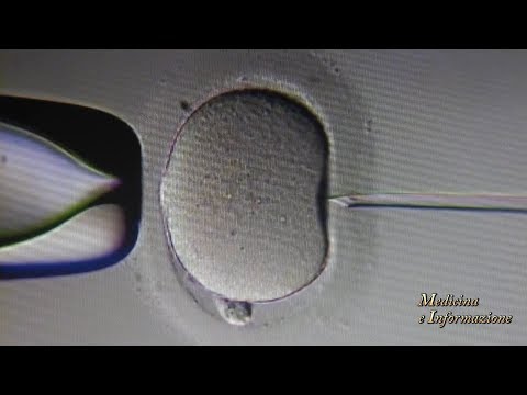 Video: Effetti Dei Polimorfismi Dell'FSHR Sull'insufficienza Ovarica Prematura Negli Esseri Umani: Una Meta-analisi