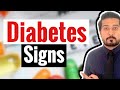 Early Signs of Diabetes You Should Know Of | Diabetes Signs