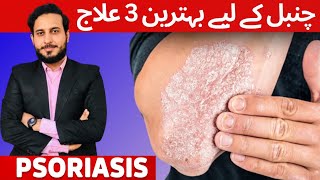 Dr.Zohaib: Psoriasis Treatment – The Best 3 Remedies for Psoriasis