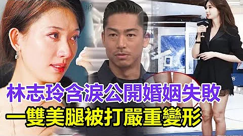 终于离了！林志玲含泪公开婚姻失败原因，远嫁日本之后被欺负，一双美腿严重变形！#林志玲#黑泽良平 - 天天要闻