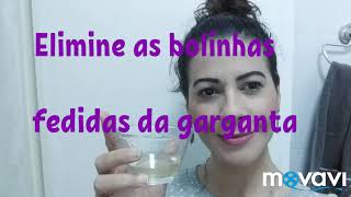 Como Acabar Com Bolinhas Fedidas Na Garganta