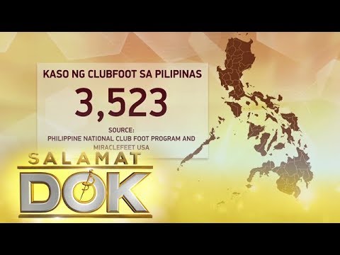 Video: Paano Ayusin Ang Clubfoot Sa Isang Bata