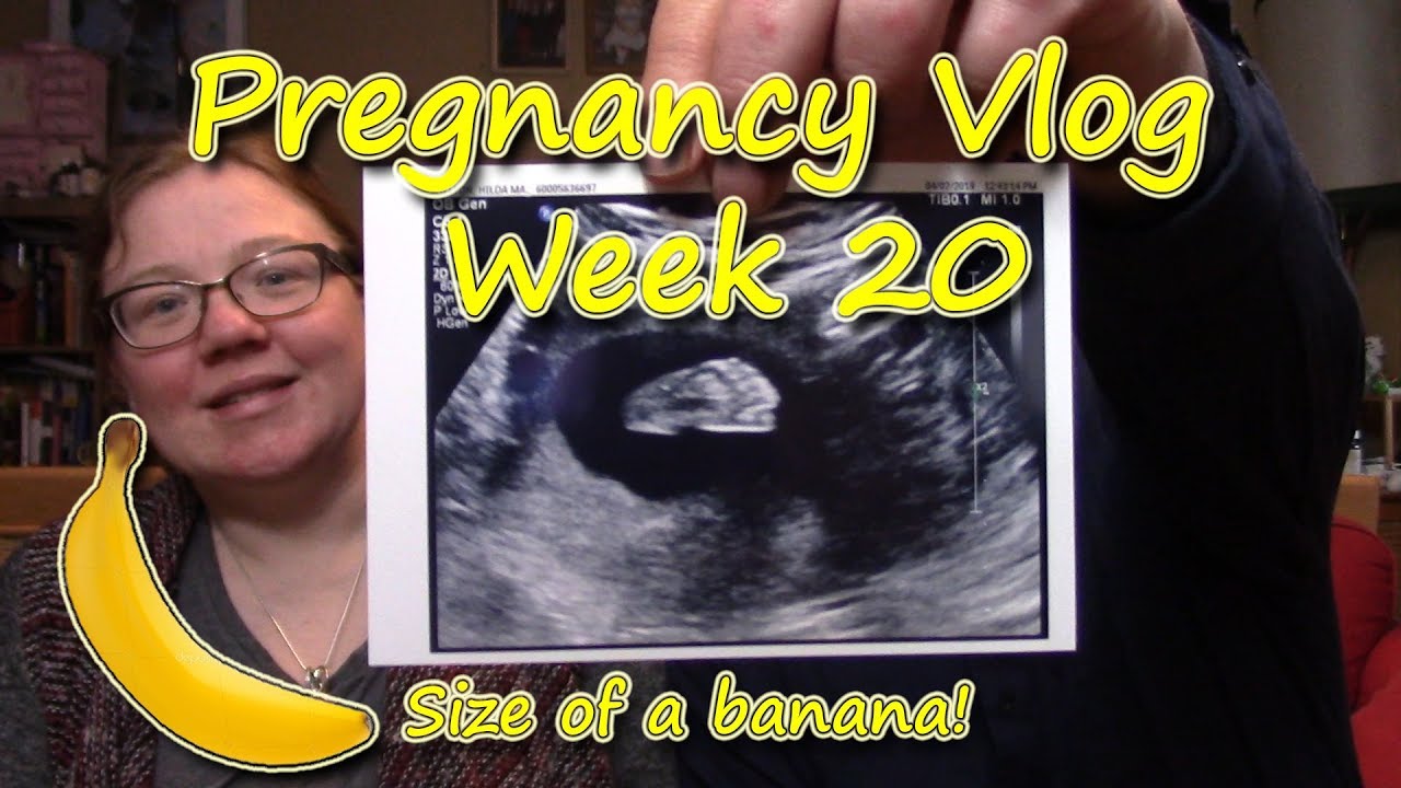 Pregnancy Vlog - Week 20 | Gender Ultrasound! - YouTube