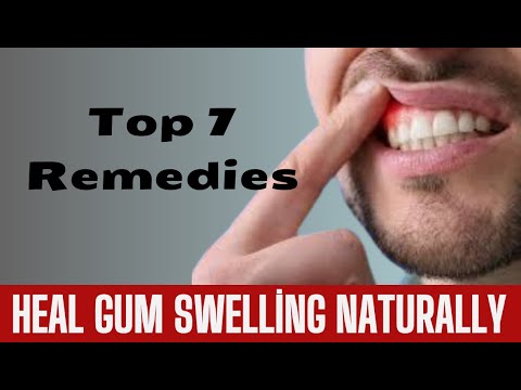 Top 7 Natural