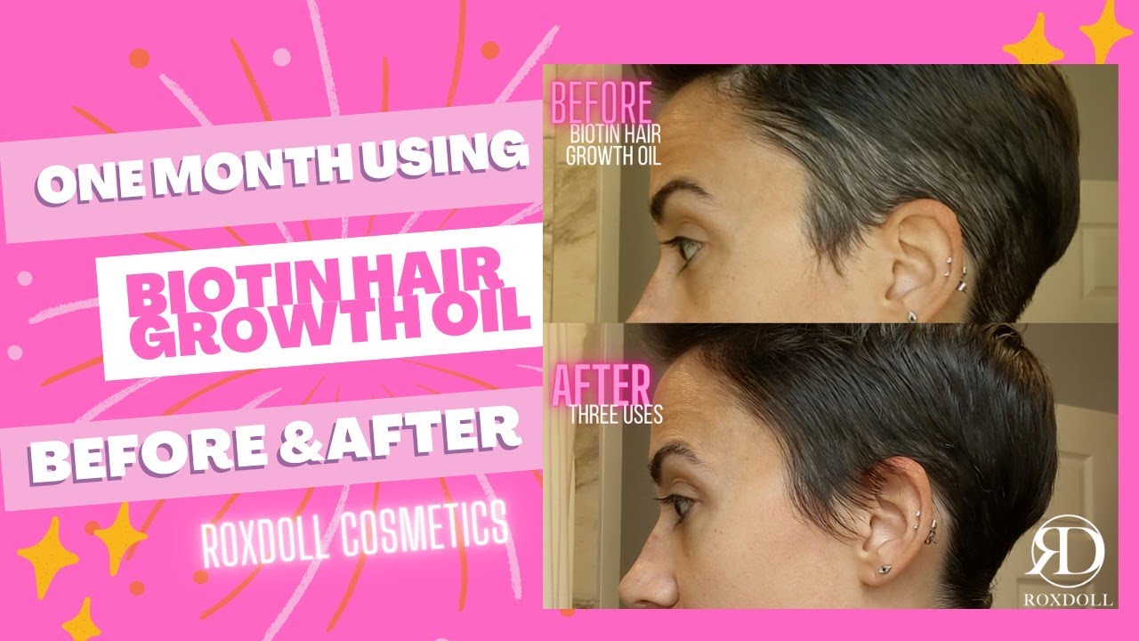 Biotin Hair Growth Oil ROXDOLL Cosmetics One Month Reviews - YouTube