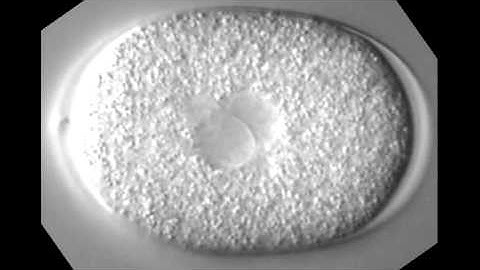 Celegans mitosis DIC