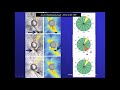 pitfalls when reading OCT glaucoma report