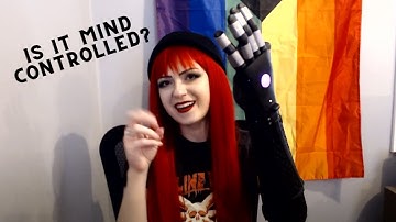 How My Bionic Arm Works (and why I don