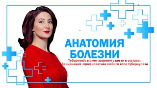 картинка: Туберкулёз может затронуть кости и суставы. Вакцинация -профилактика любого типа туберкулёза