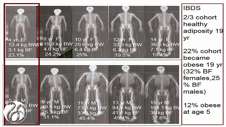4/14/2015 - Panel 1: Everyday Physical Activity and Its Role in Preventing Obesity