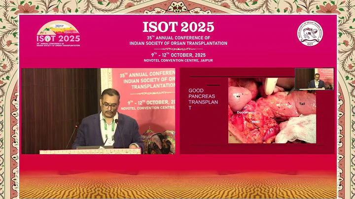 PGI experience of pancreas tx