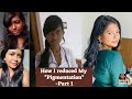 Must watch this is how i reduced my hyperpigmentations  part 1  in tamil  truly sana 