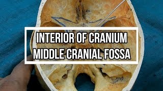 Middle Cranial Fossa