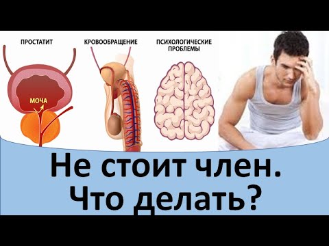 Половой член человека — Википедия Половой член человека — Википедия