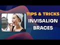 Invisalign braces tips and tricks You didn&#39;t know about!!!