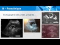 Conftube ECNi #75 - Hypertrophie bénigne de prostate - topo