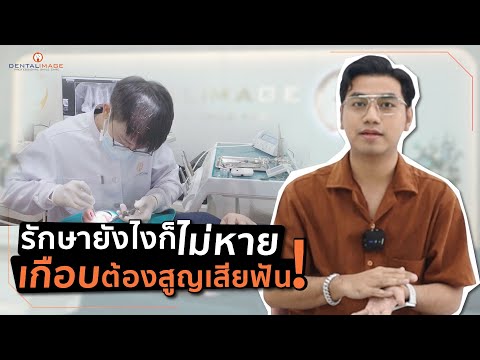 รีวิวรักษารากฟันจากคนไข้จริง