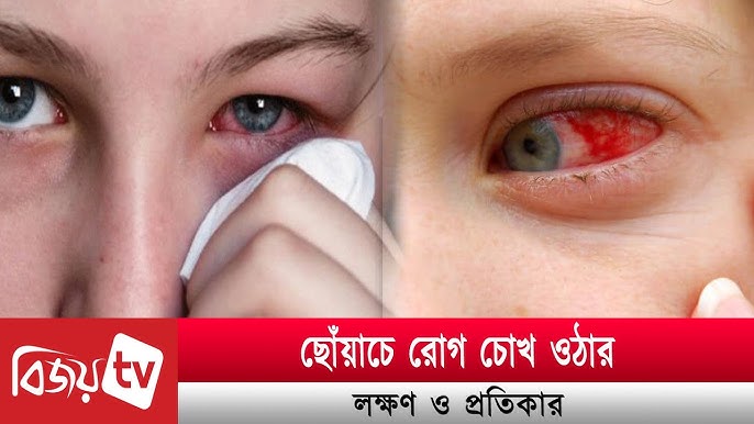 Yetuk kaltak ikki nigga sikishadi