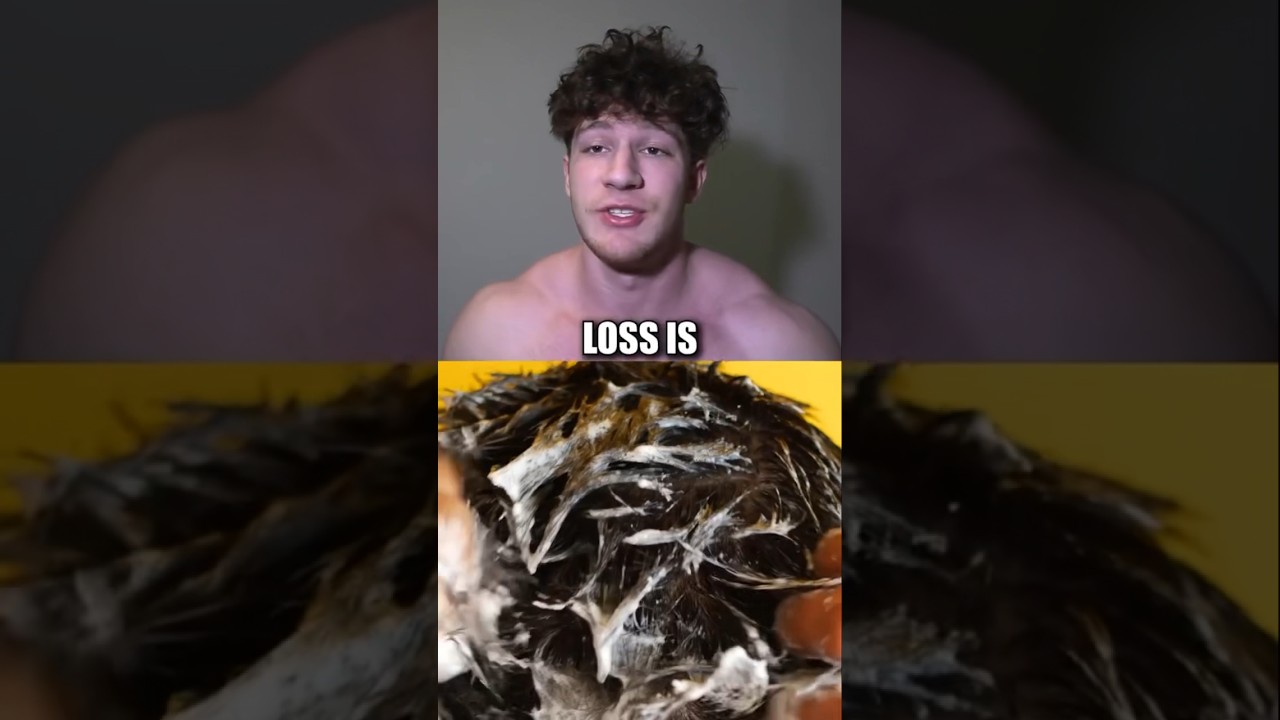 WATCH THIS TO NEVER GO BALD 👩‍🦲 #fitness #hair #hairloss #moreplatesmoredates #gym #men #menswear
