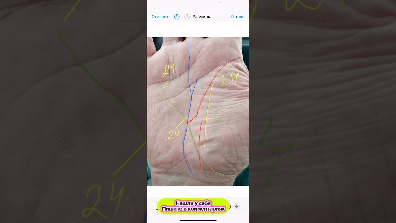 Разрыв на линии жизни