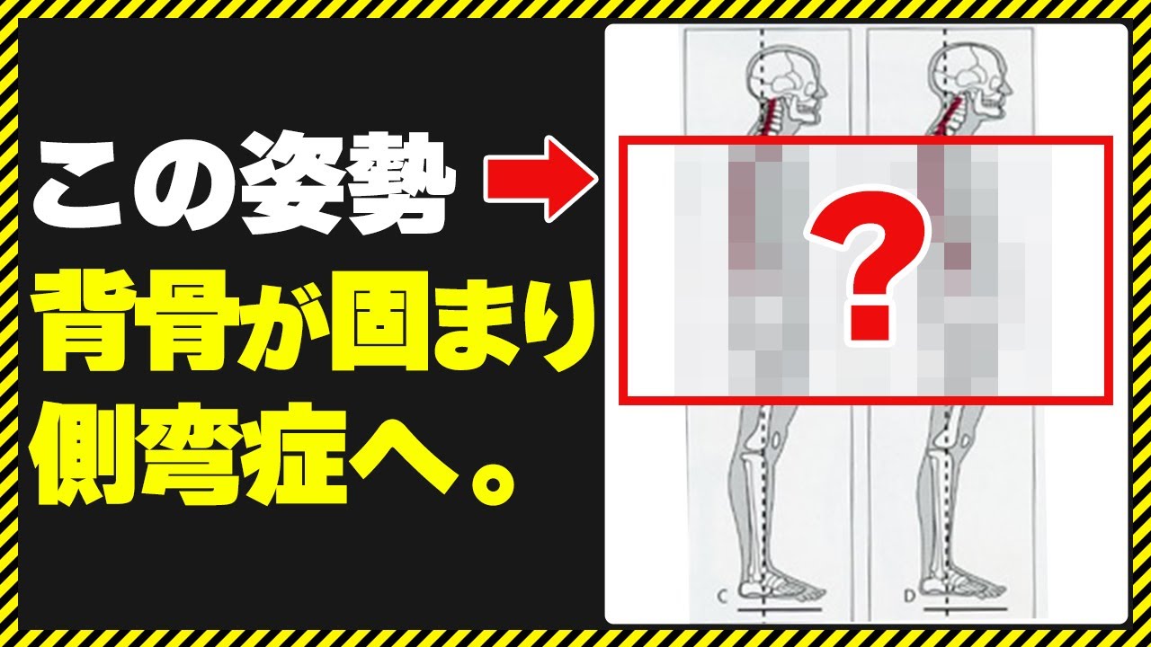 側 弯症 やってはいけない こと