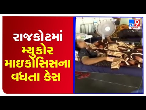Mucormycosis cases on rise in Rajkot, more 15 cases reported in last 24 hours | Tv9GujaratiNews
