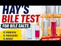 Hay's test for bile salts biochemistry practical #biled #biochemistry 