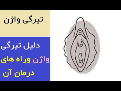 تصویری: چرا پارگی من سفید است؟