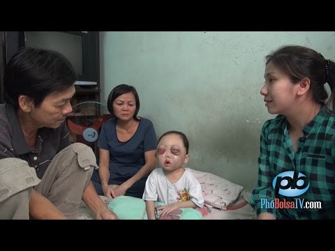Video Bé gái xấu số, 2 tuổi đã bị mù mắt và bệnh ung thư máu - youtube